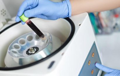 What To Know About  Applications of  Laboratory centrifuges