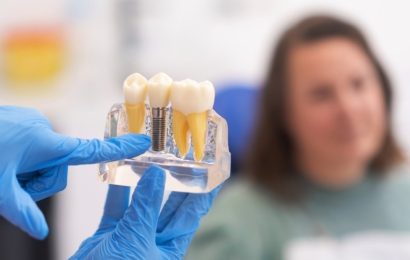A London Implant Specialist Explains 8 Factors That Influence Dental Implant Longevity in London