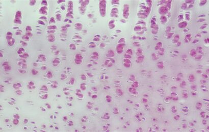 Building a More Informed Future for Cancer Diagnosis