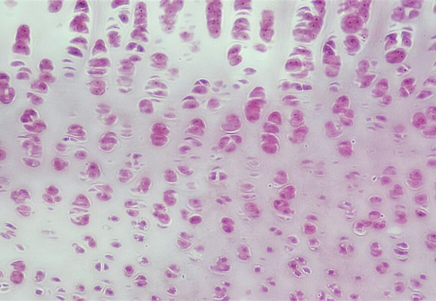 Building a More Informed Future for Cancer Diagnosis